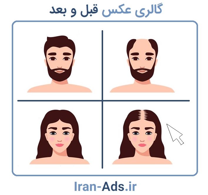 گالری قبل و بعد
